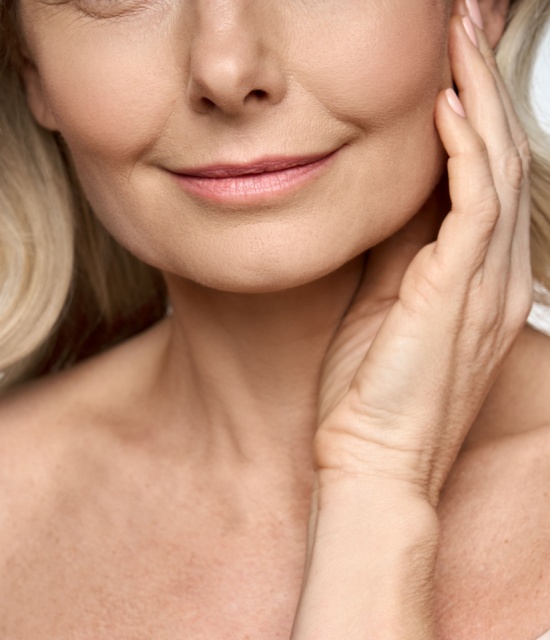 sculptra patient